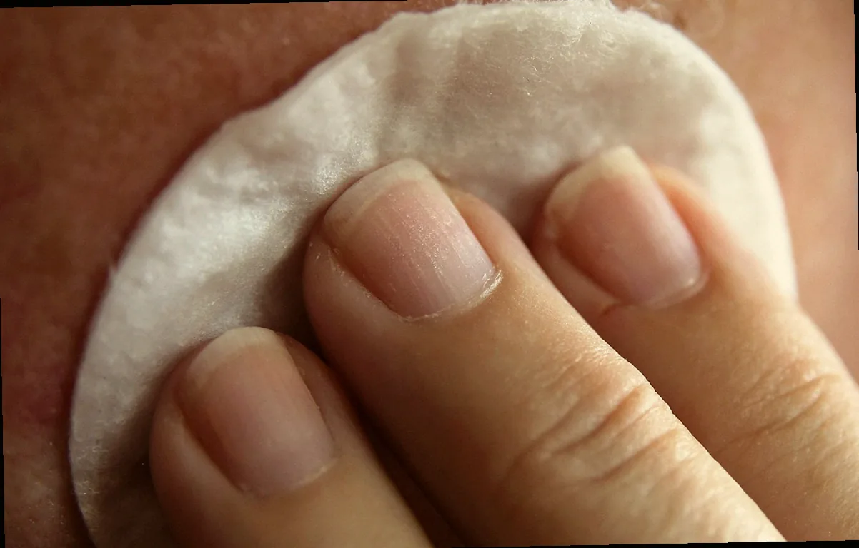 մաշկի բծեր կանխարգելում