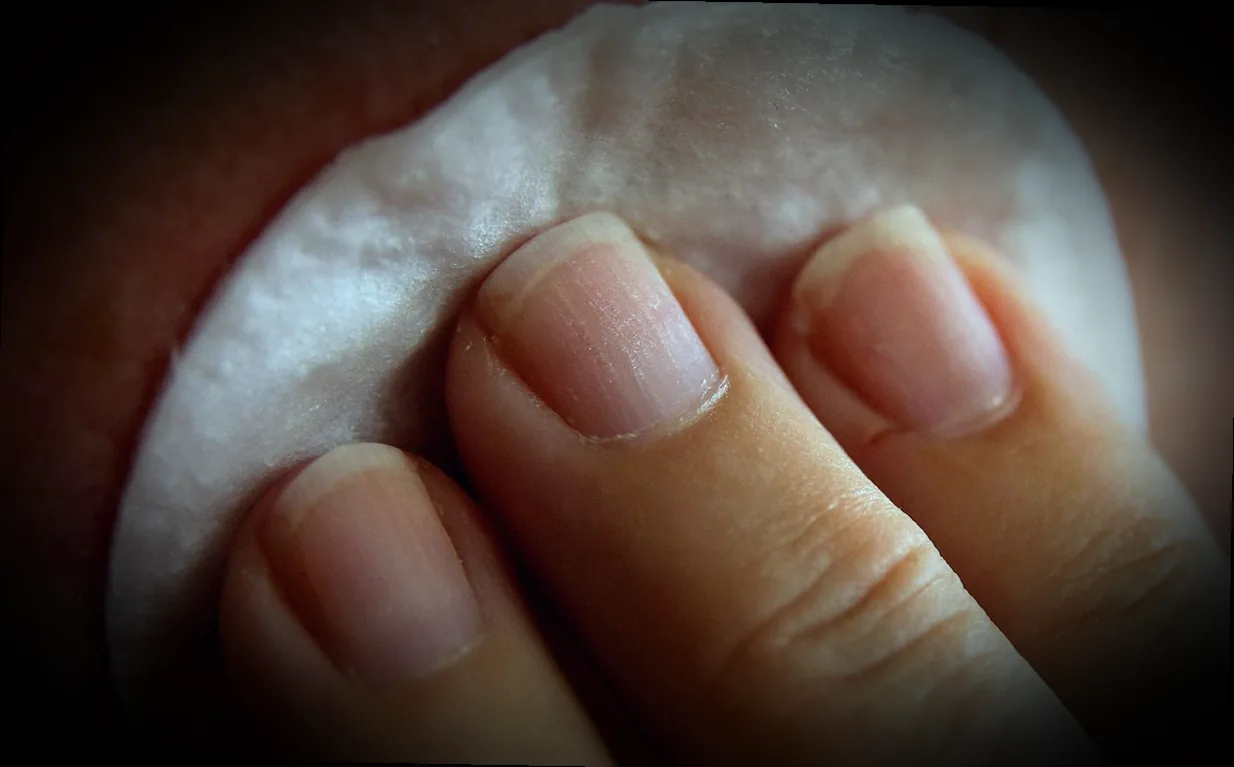 մաշկի վնասվածքների բուժման եղանակներ